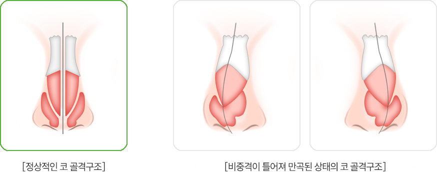 이미지명