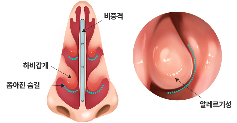이미지명