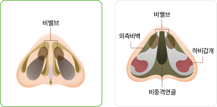 이미지명