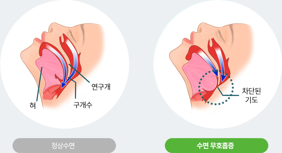 이미지명