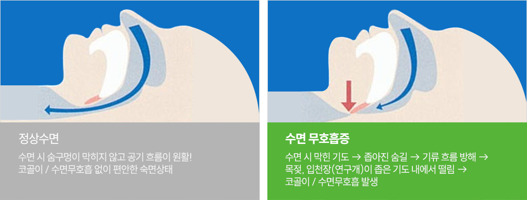 이미지명